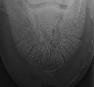 Pedal Osteitis X-Ray in Horse
